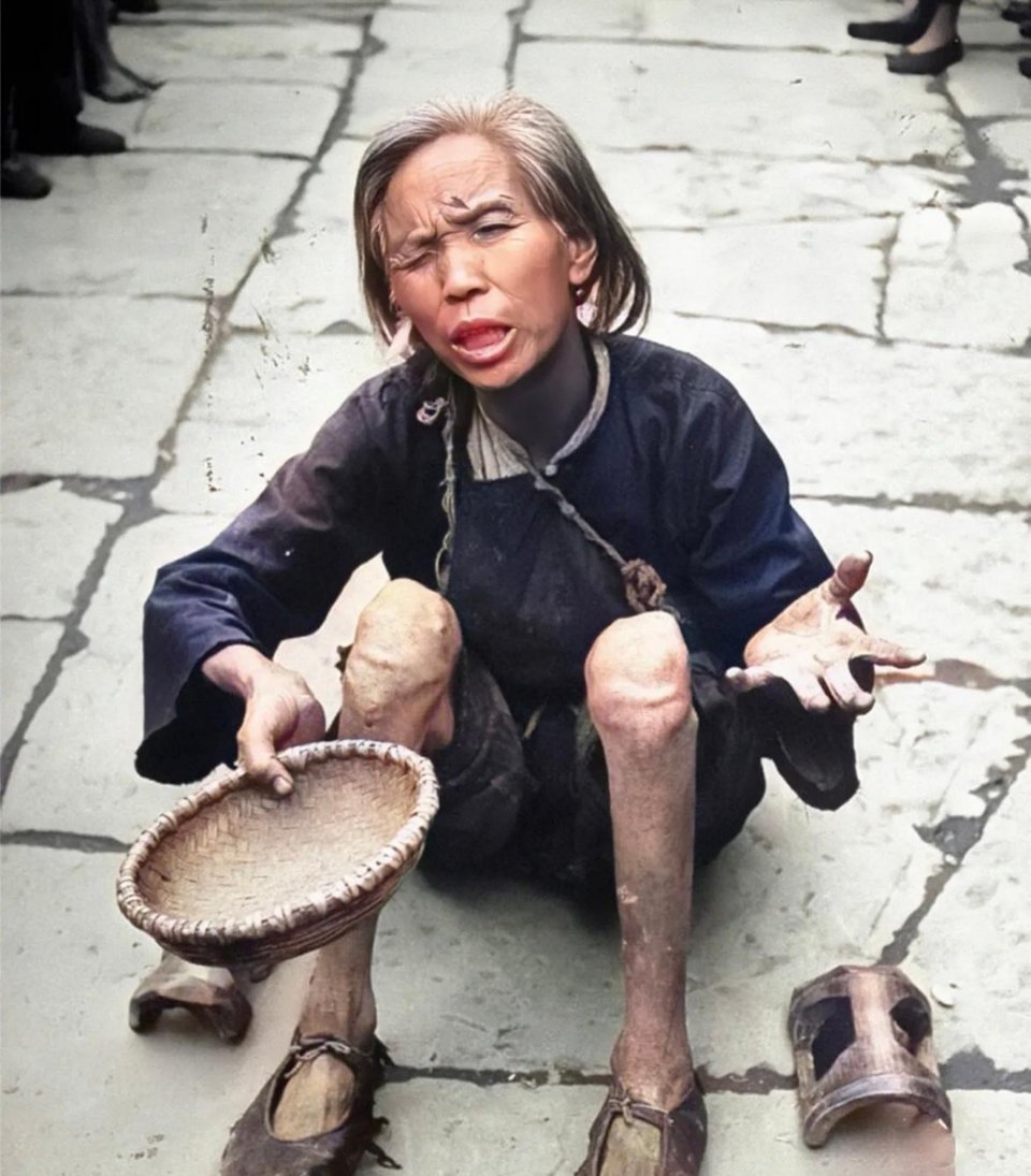 #历史那些事[超话]#老人一只眼睛看不见，双腿行走困难，已经丧失劳动能力，只能靠