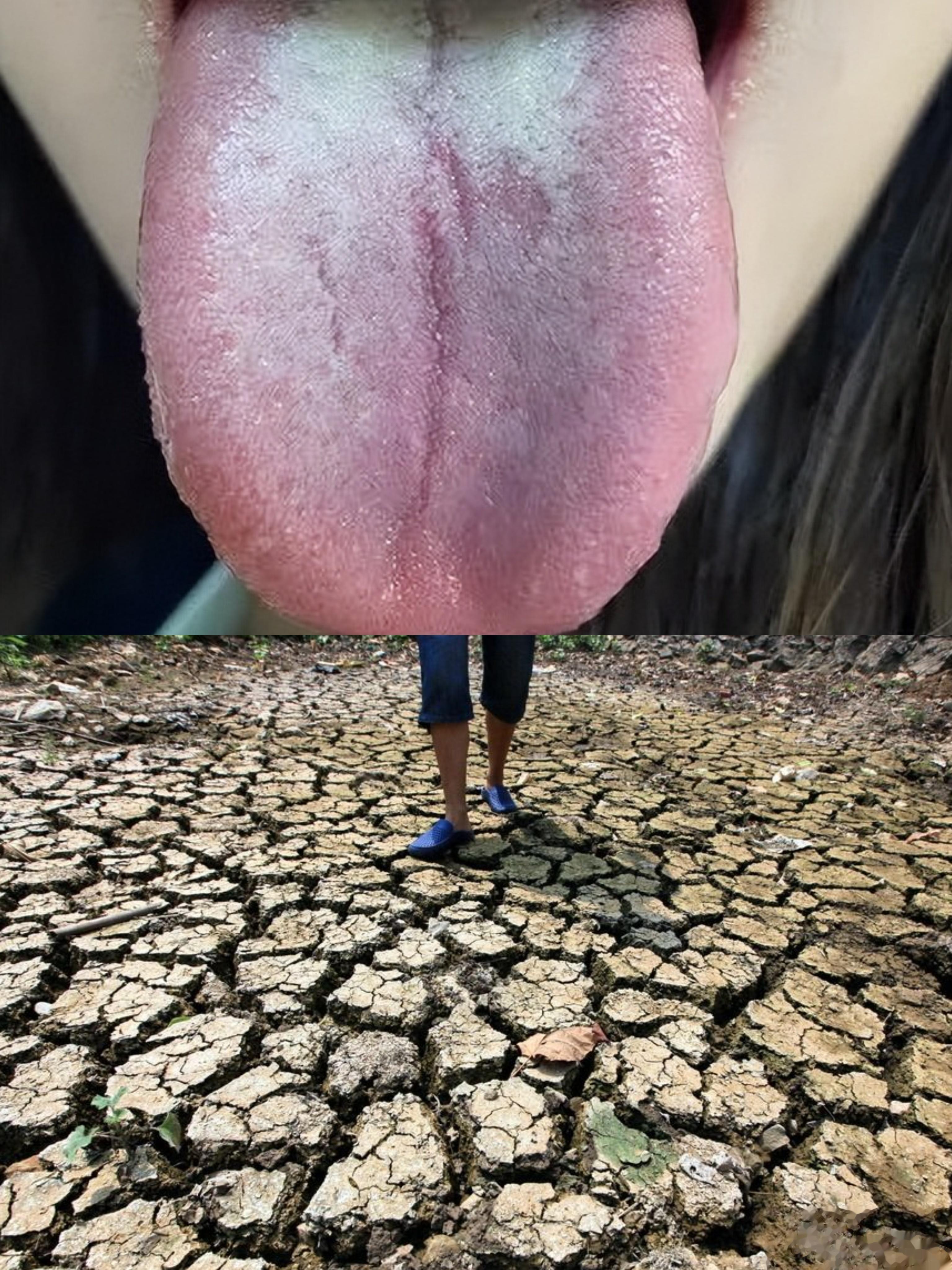为什么舌头中间裂纹很深？大地干涸了才产生裂缝。素体阴虚之人，经络干涩，身体枯燥，