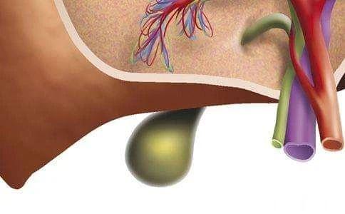 专方专病：柴胆牡蛎汤治疗慢性胆囊炎[赞]柴胆牡蛎汤可以作为治疗慢性胆囊炎的基础方