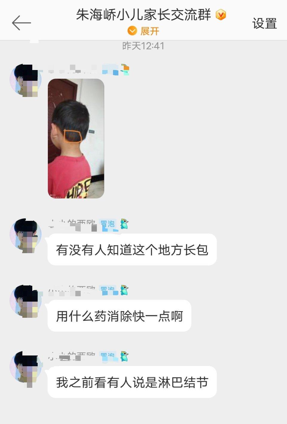 【小儿后脑勺长个包是怎么一回事？】#儿童常见病必备手册# 有家长问:孩子后枕部长