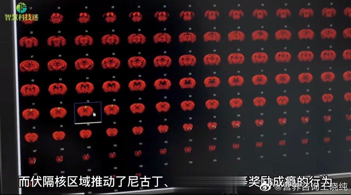  这项最新的研究其实就是说易胖的人大脑结构发生了变化，大脑细胞的营养物质难以进入