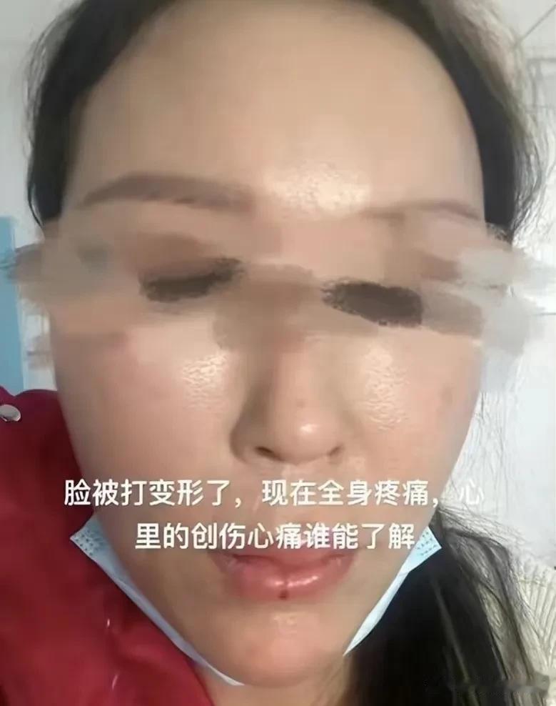 是不是大家一下子就想到了去年夏天的“唐山烧烤店打人案”呢？看起来情形也有些类似