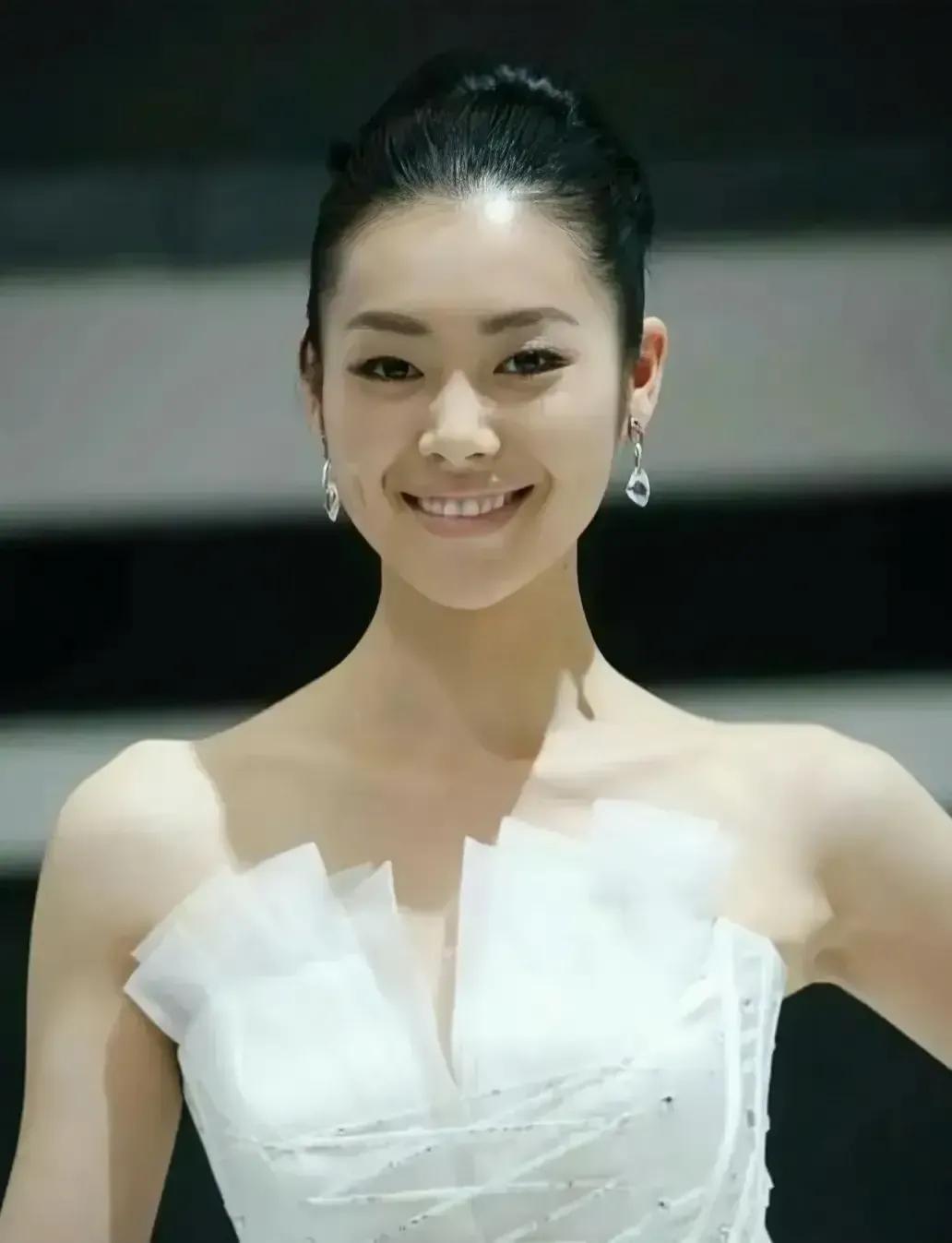 “大表姐”刘雯以前的时候健康美丽，笑容迷人，现在的她两颊凹陷，身材干枯，瘦得吓人