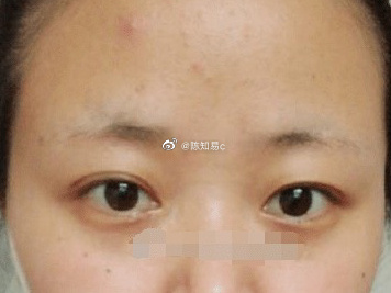 看到昨天的微博评论，有些粉丝关心有这些不好的特征该如何改进，这些内容往后都会讲到