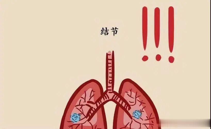 ​肺结节，没那么可怕！这两个方子来帮您！[赞]常兆友  前段时间，有个企业老板在