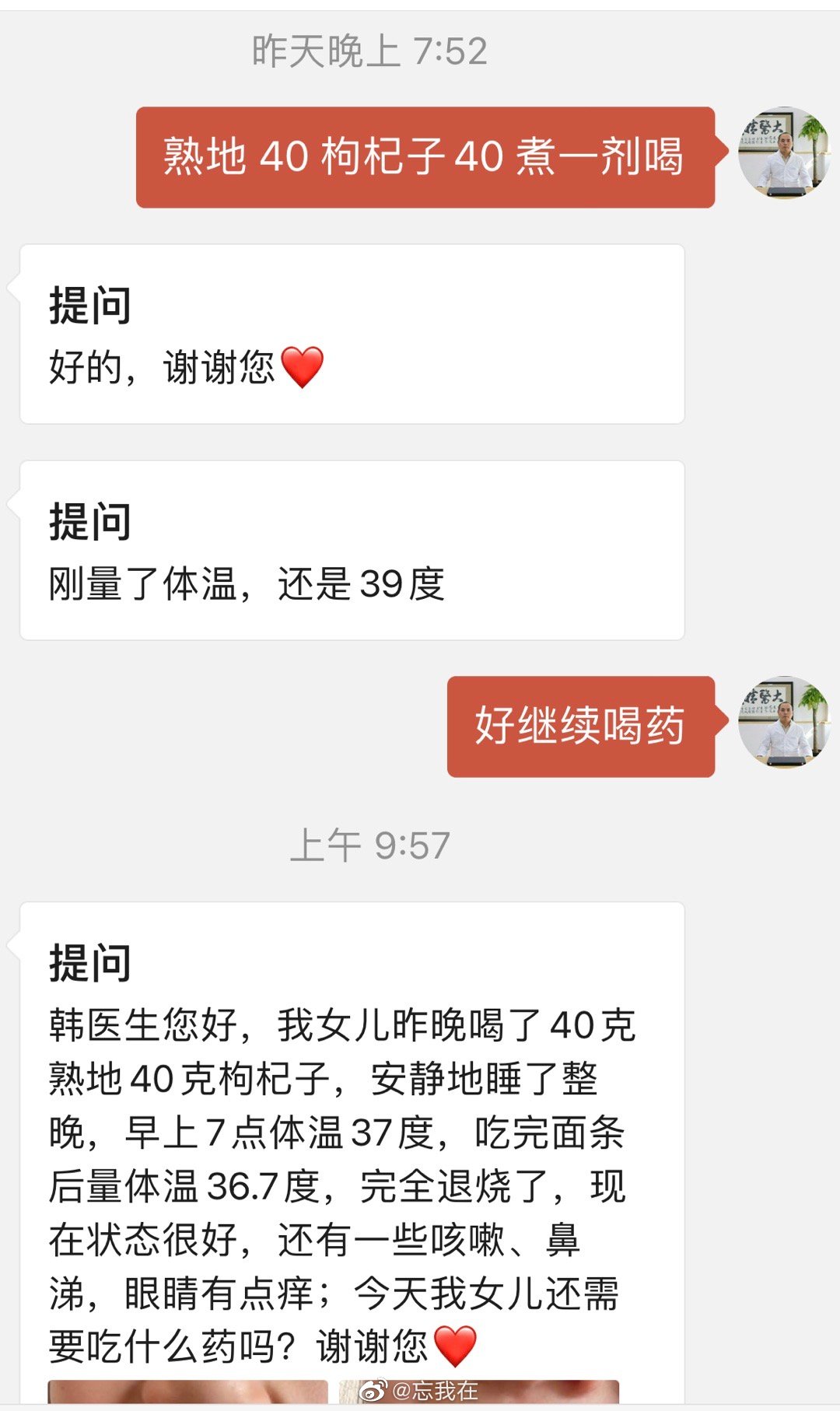 春温，阴虚血虚 ​​​