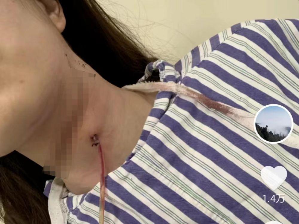 割喉不是家暴 ！
这位丈夫每次都把妻子打得满脸是血，孩子也被打流产，事后总会“求