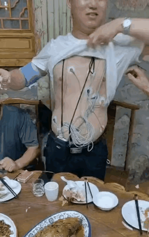 大兄弟满身插的都是医疗线管，还在坚持喝酒[泪奔]还主动要连干三杯白酒，不醉不归。