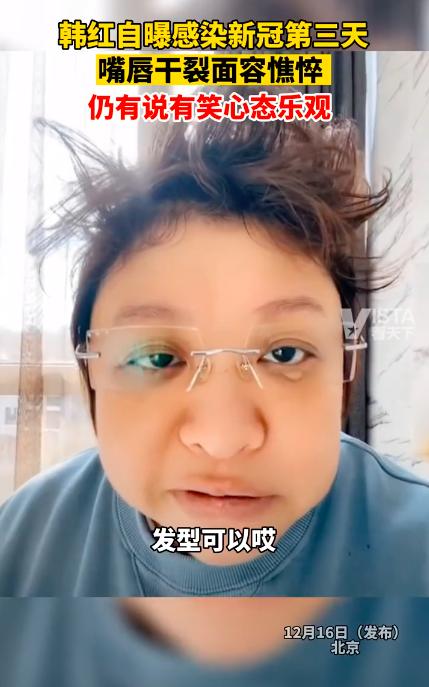 韩红感染新冠之后的模样和症状有