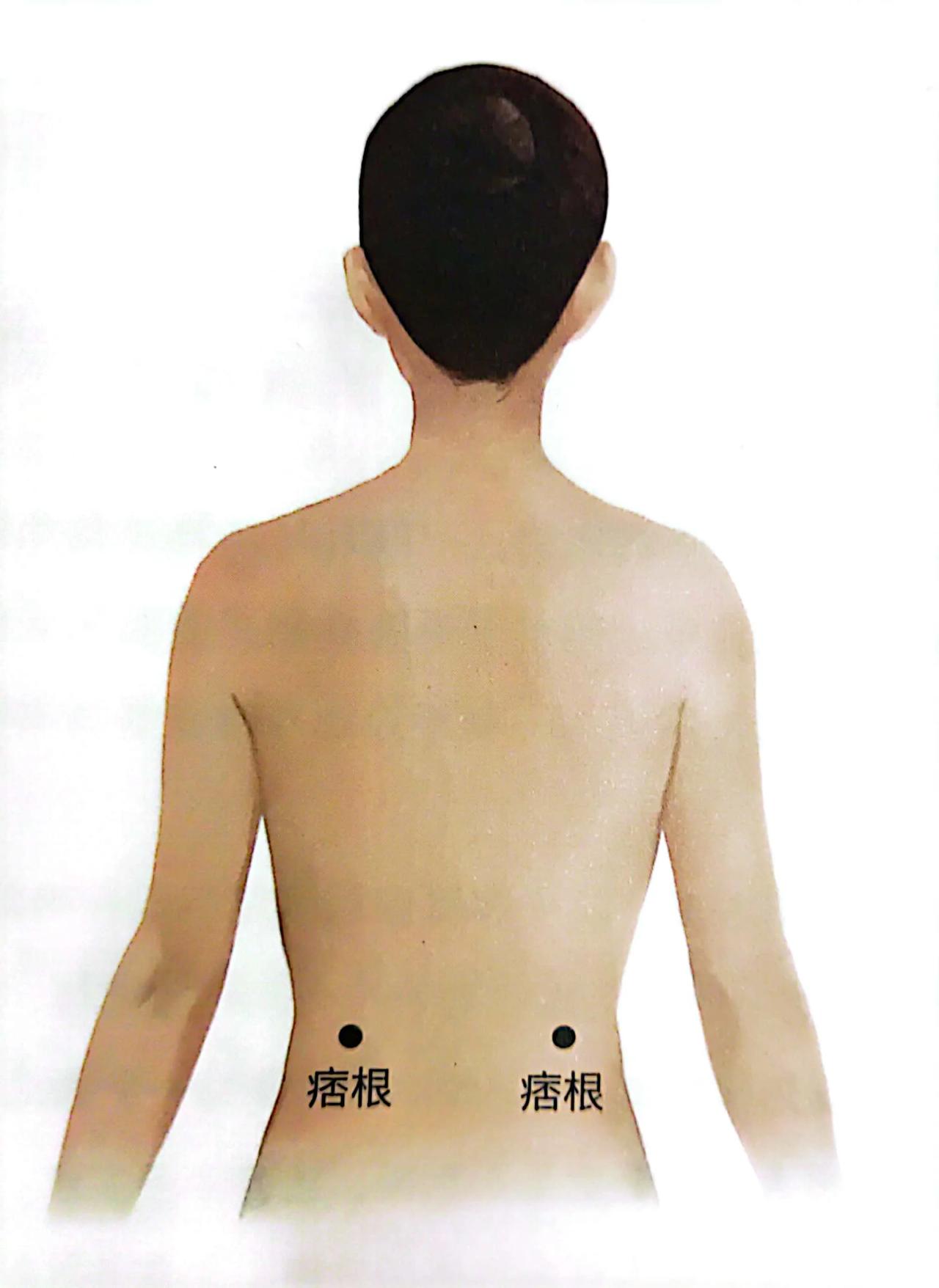 介绍一个用于腹部肥胖的艾灸[赞]
       这个穴位叫“痞根”，是明代医家张