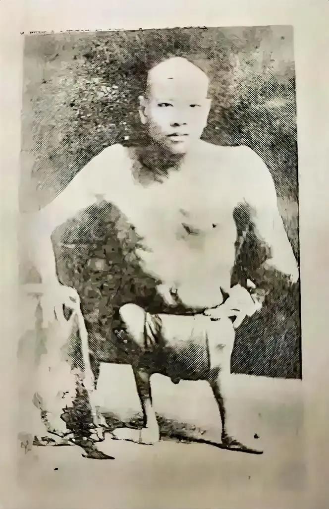 这位可怜的残疾乞丐，我们无法判断他的残疾是自然发生还是被人为导致。他只能靠着手中