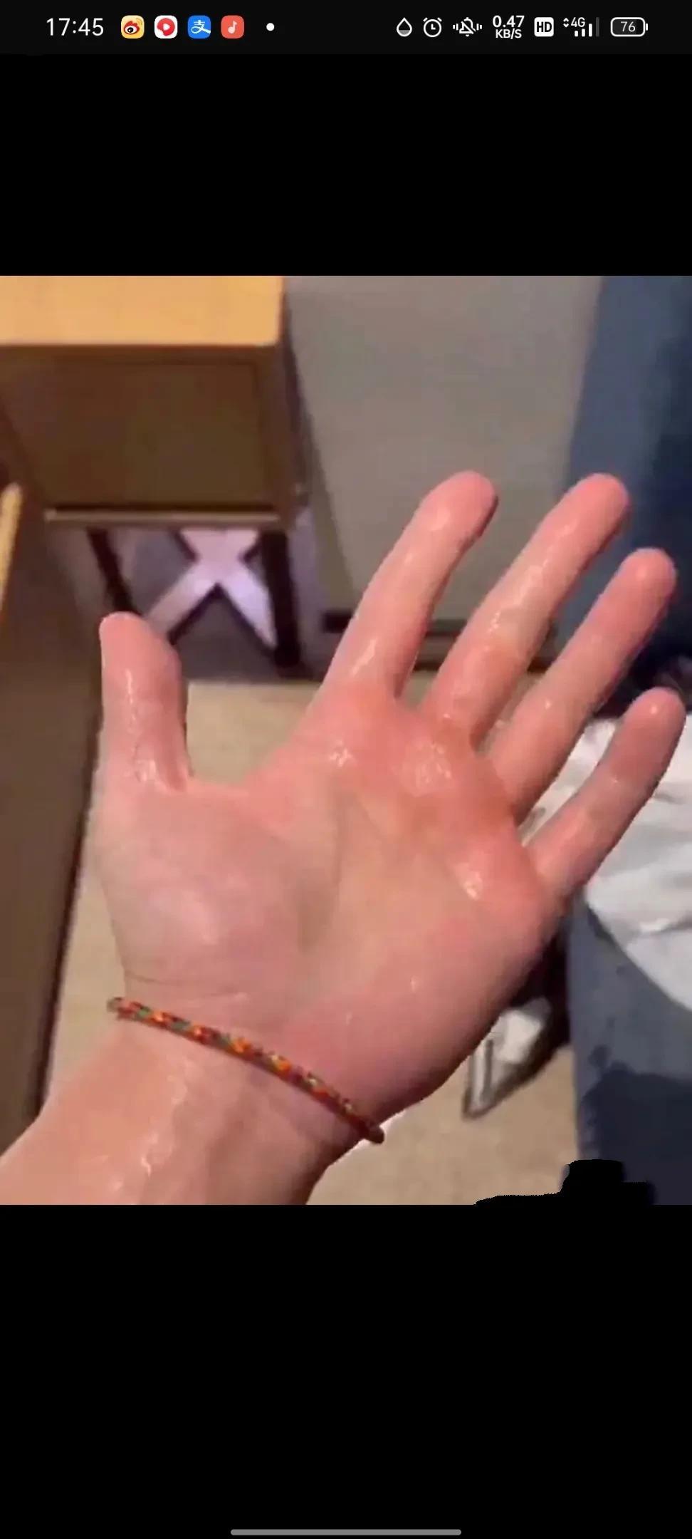 那些感染艾滋病的人为什么不能戴安全套，这样就不会感染了，我告诉大家怎么预防艾滋病