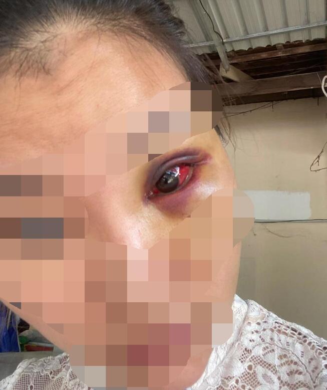 女子被强奸、被威胁翻供！老乡竟是柬埔寨杀猪盘的头目！
3月2日一早，王女士还在家