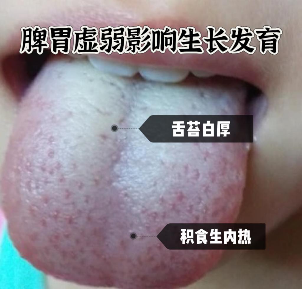 孩子身高不理想，干预身高最佳年龄是几岁？很多家长问过我这个问题，统一回复下大家：