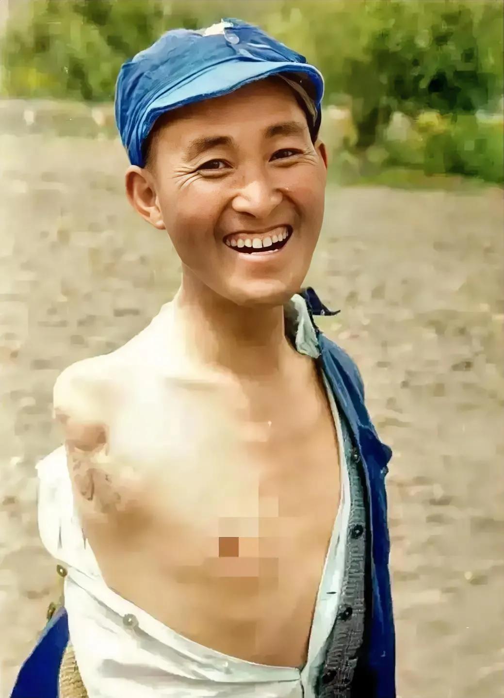 难以想象，一个因战争被截肢的人，竟有着如此阳光般的灿烂笑容。

1944年，八路