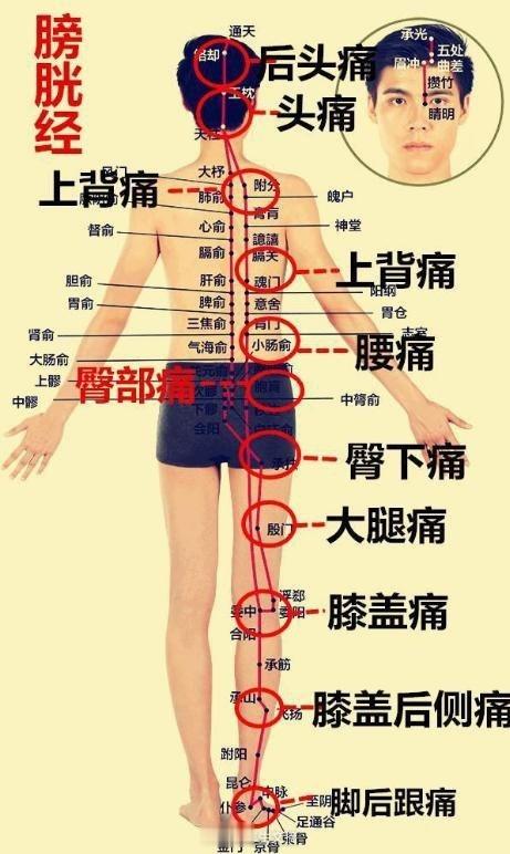 临床【痛症用药】经验总结，根据身体痛症部位的不同，我们常选择不同的中药方剂：1、