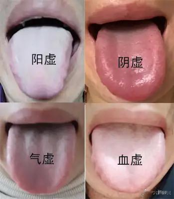 阴虚、阳虚、气虚、血虚的食疗方来了 1：阴虚：就好比大地缺水，到处都是干枯的。所