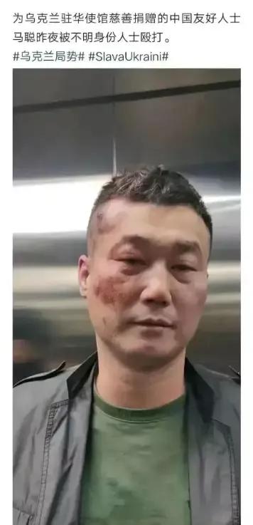 鸟粉被打[惊呆]我一直以为大家最多只是在网络上嘴炮一下而已，没想到真有(正义之手