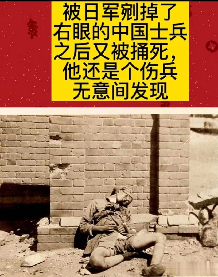 这个士兵眼睛被剜掉了，大家仔细看一下啊，右臂上还有个甲板，那证明他是一个伤兵，死
