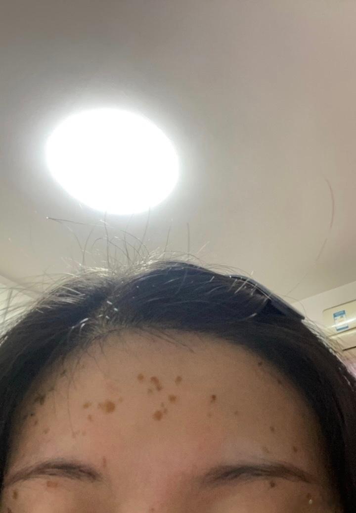 盐水巧治扁平疣今天无意间听一位阿姨讲他儿子手脚手脚乌紫容易起冻疮同时手掌、脚掌长