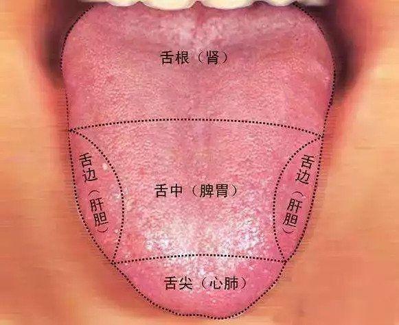 舌象看出脏腑的气血状况这位患者舌头两侧胖大，说明肝气郁结。黄色圆圈代表淤血点，肝
