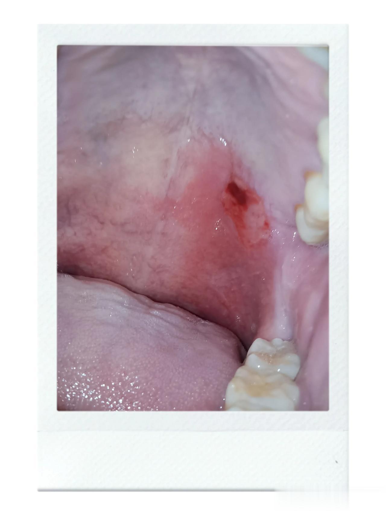 真疼！！！我就是下意识的咽了个