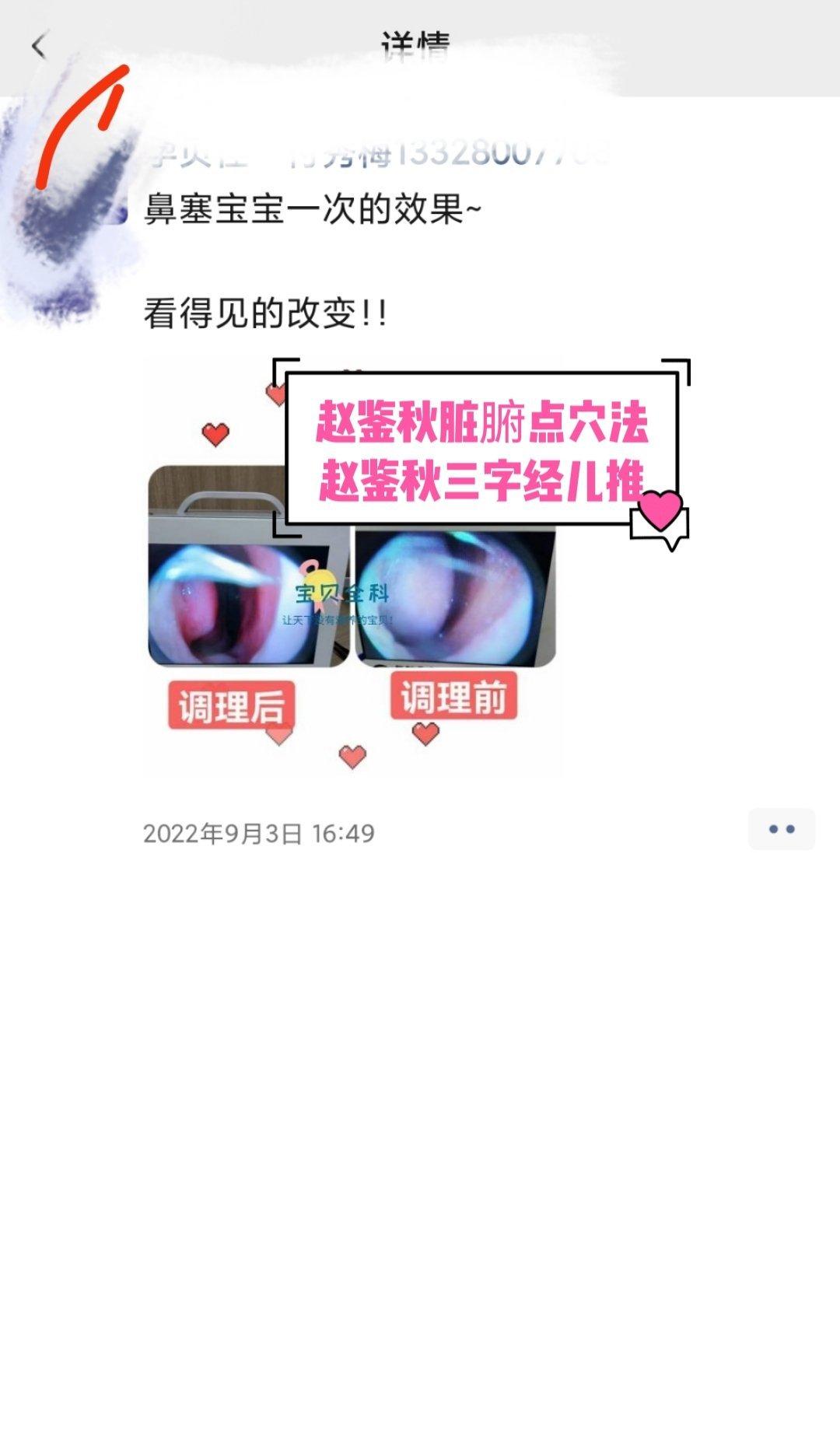 咳嗽有痰食疗方：（1）如果说孩