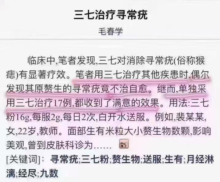  疣从中医来说：是淤堵赘生物，
