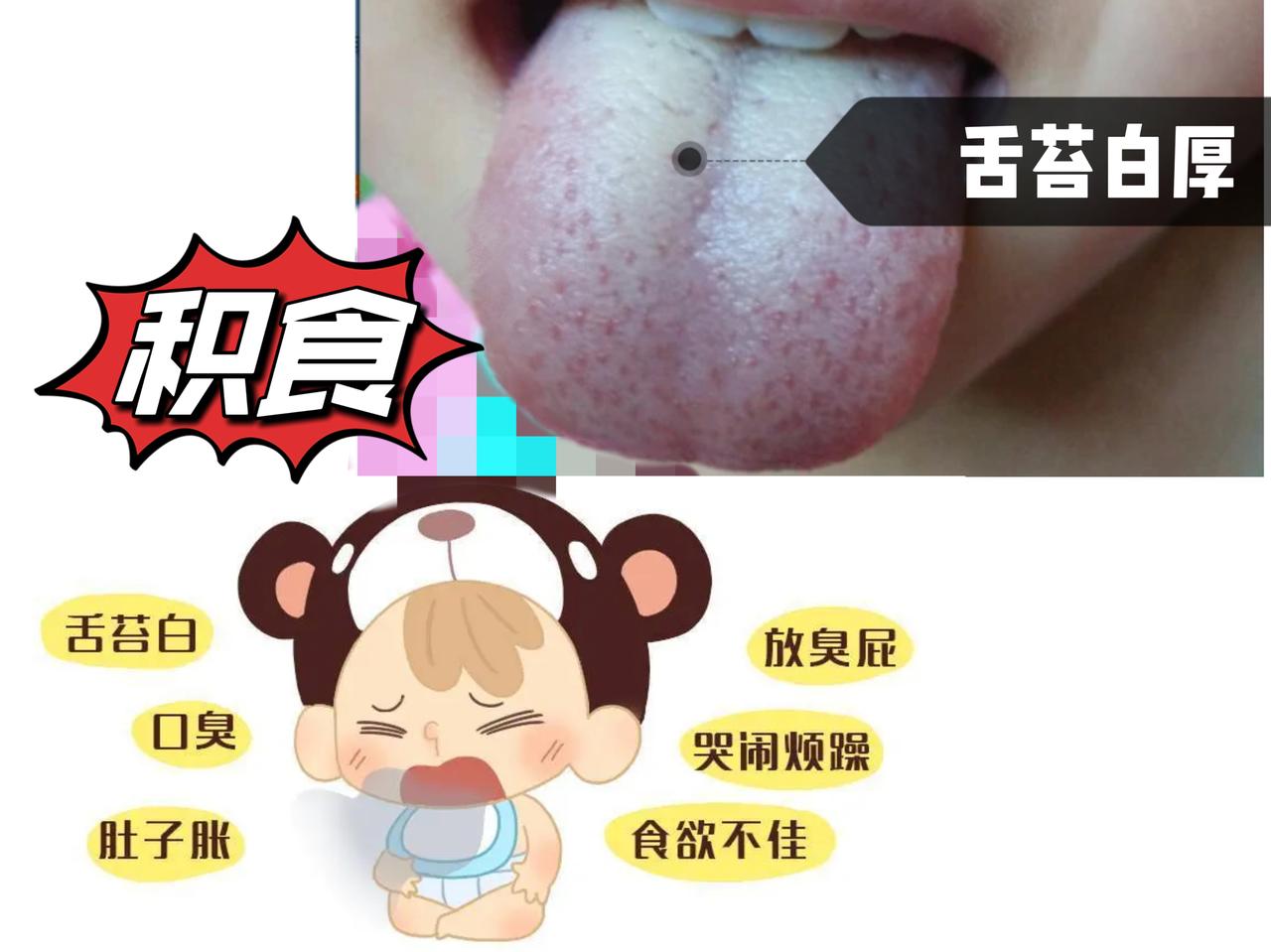 【家长们可能想不到】孩子口有味，别忽略，这可能是“求救信号”，身材矮小是有原因的