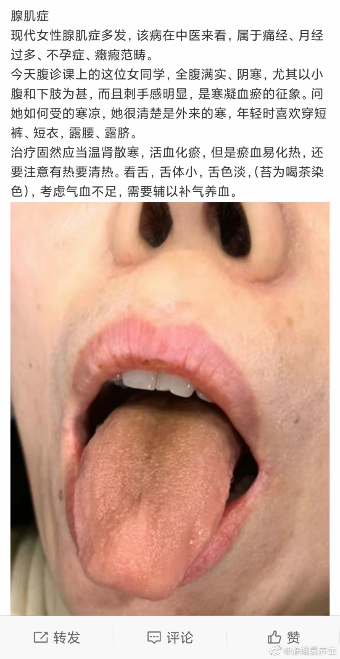 #苗药养生# 年轻时肆意潇洒要风度不要温度就像一盆水遇冷则凝滞人也一样让自己从臟