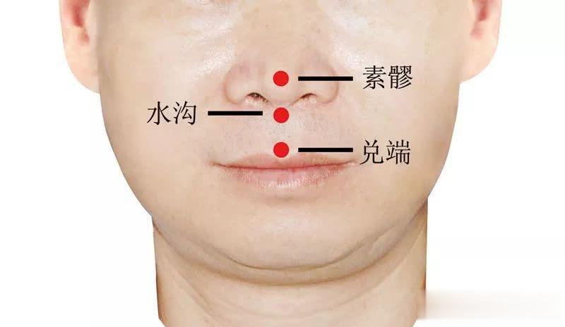 针刺“人中”抢救药物过敏性休克[good]取穴及操作方法:取人中穴（也叫水沟）,