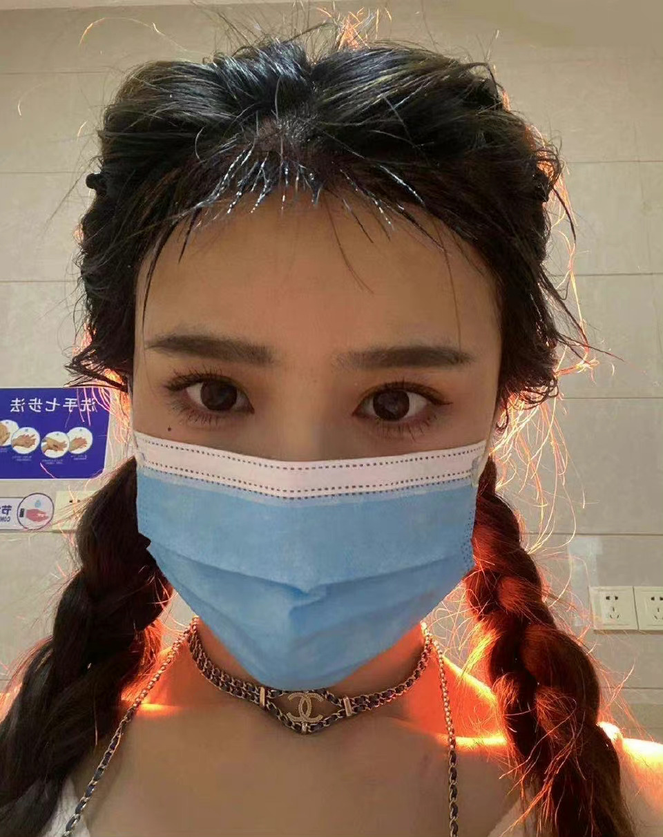 姐妹们不剃发植发是真的香（图1