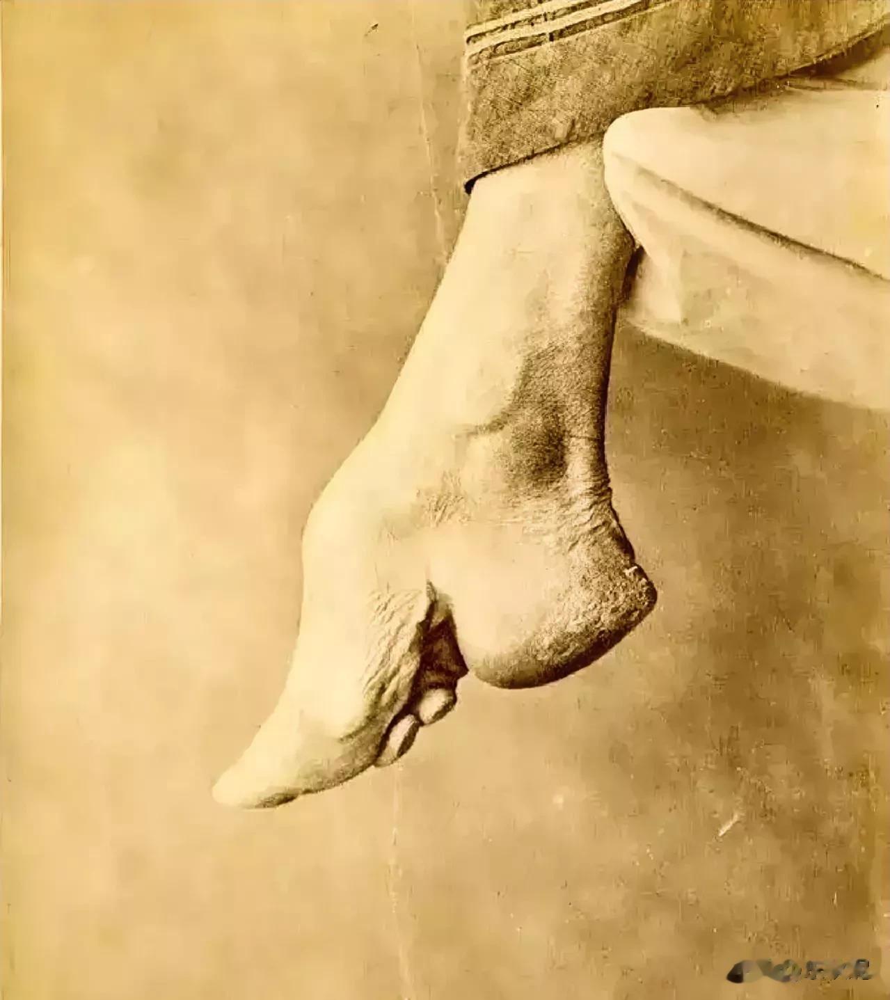 这是1900年，一名清朝女子的“三寸金莲”。

有人看图提问，古人是不是看了西方