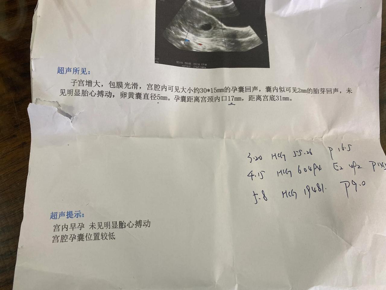 快三个月了一直没有胎芽胎心，医生说是空囊叫流掉。不甘心在家保胎保了一个星期，吃的