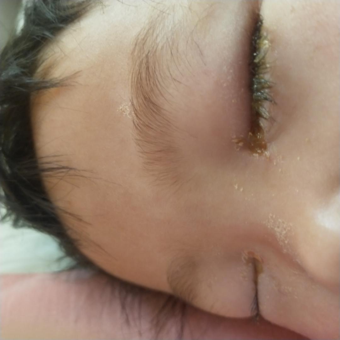 如何判断孩子是不是上火？看这4个部位分辨！
 
1、眼屎多，发黄——肝有火
家长