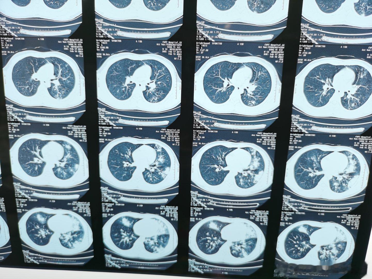 #家庭健康守护计划# 新学期伊始，诺如病毒和流感病毒最近又成了热门话题，给家长科