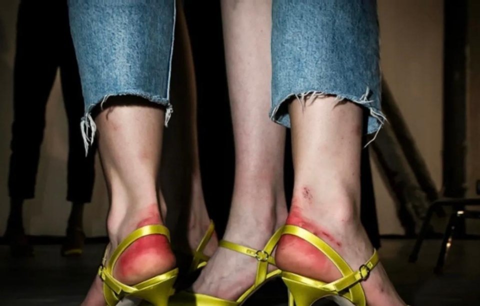 #历史那些事[超话]#2019年纽约时装周，记者捕捉到一位女模特的脚踝。可以看到