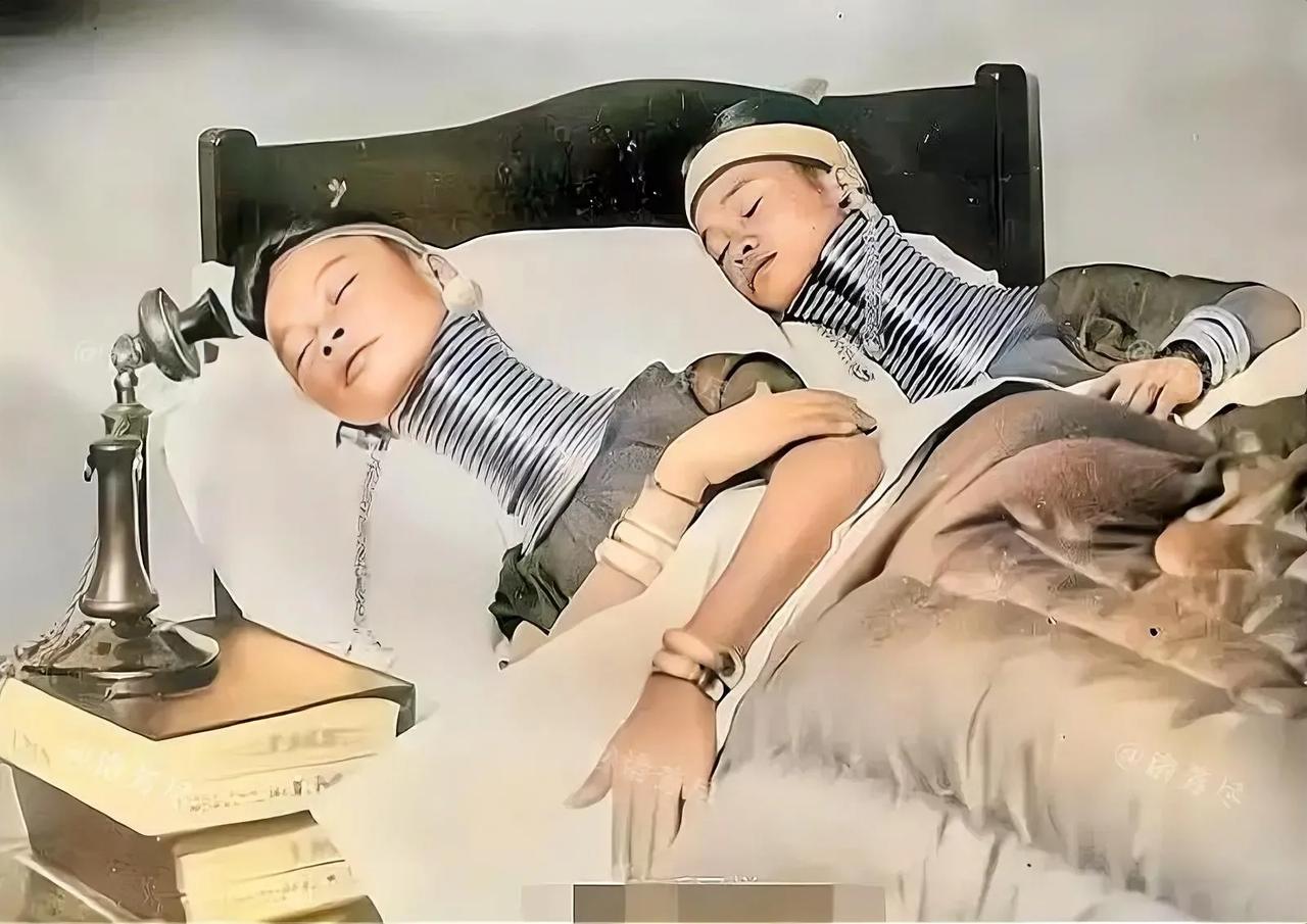 1935年，一张罕见的照片在伦敦传开了。照片中的两名“长颈族”女孩儿正在睡觉，但