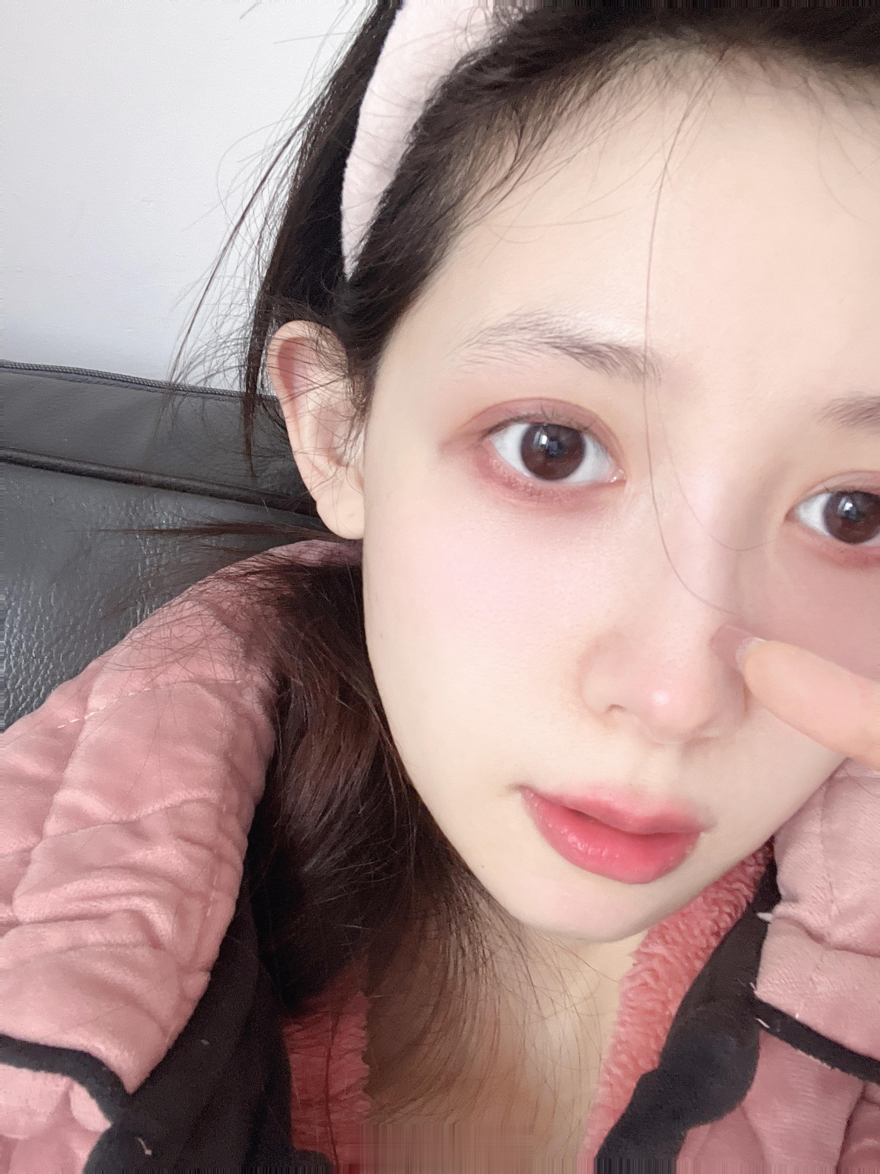<p>感觉发烧完皮肤变好了哈哈