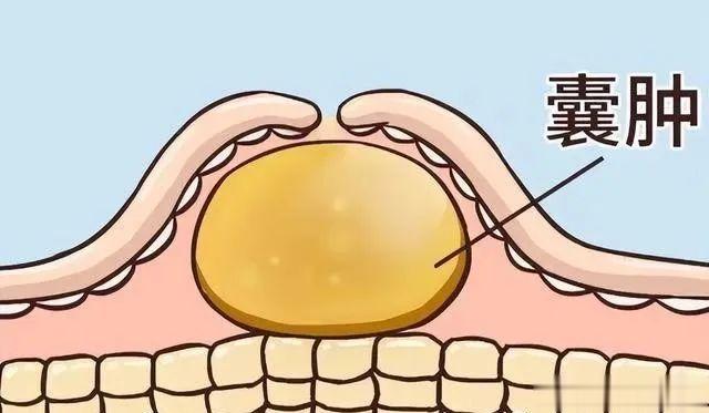 一味中药煮水，化散全身包块、结节、囊肿、息肉[ok]中医博士王树鹏  王树鹏教授