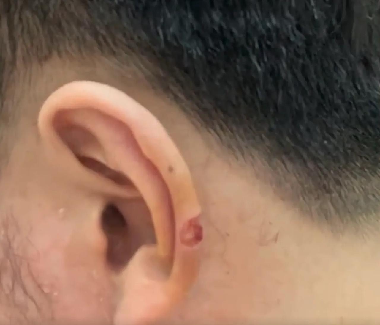 男子去理发，耳朵被剪掉一大块肉，还被理发师冷嘲热讽说不影响工作生活。

1月18