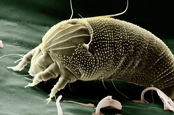 除螨工作，首先要解决的就是湿度问题。#儿童健康守护计划# ①螨虫喜湿怕光，在湿度