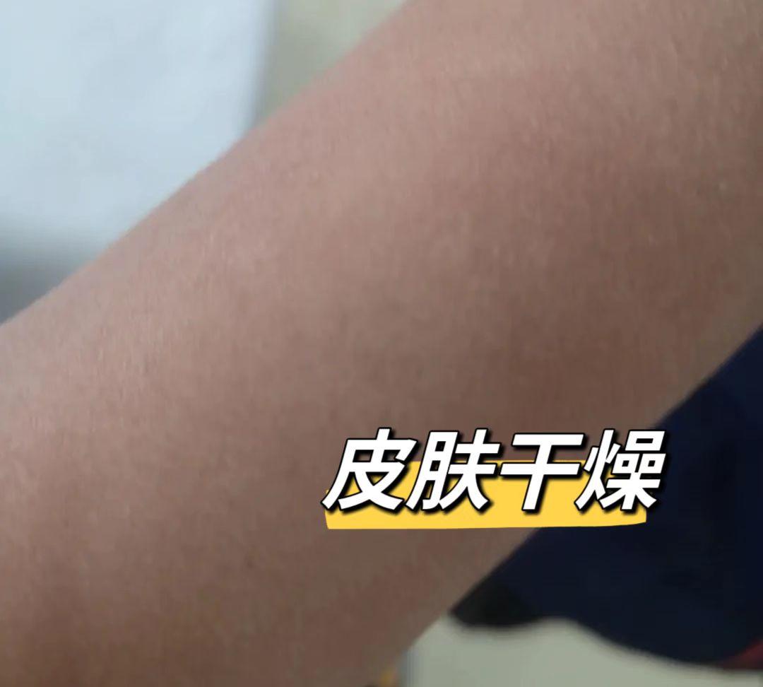 广东的一个9岁小男孩因生长问题而来找到我,孩子身高仅有123cm，已经被归类为矮