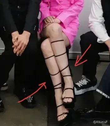 不懂就问：阿SA腿上为啥要用绳子，绑得像粽子一样？是在治疗静脉曲张吗？[捂脸]感