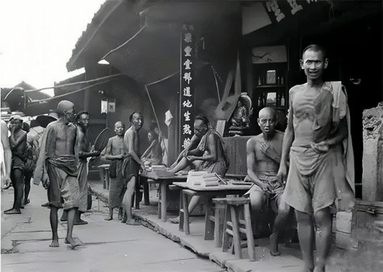 这才是100多年前的清朝老百姓的真实样子，饿得瘦骨嶙峋，前胸贴后背，别再被电视剧