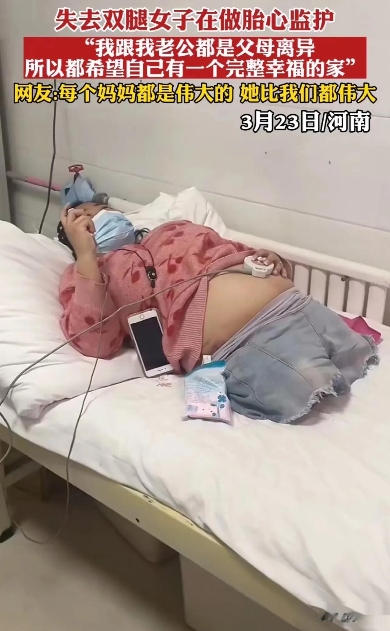 泪目！河南，失去双腿的女子去医院做胎心监护，可把医生给震撼到了！她只有半截身体，