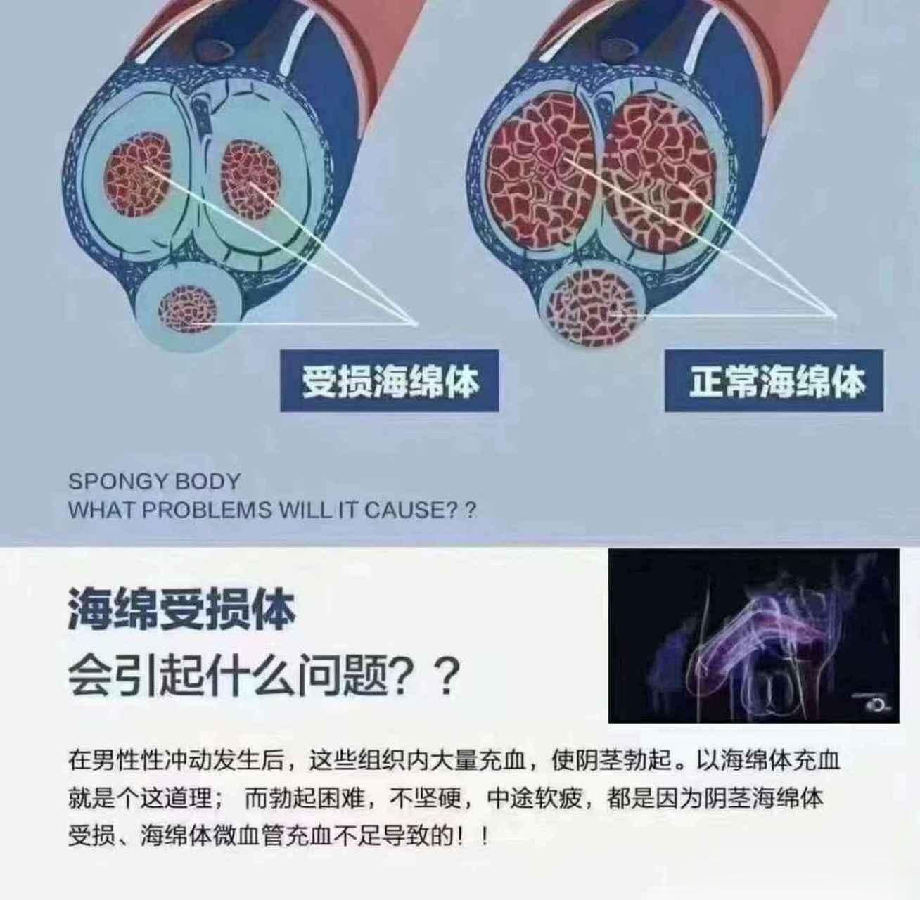手爱导致海绵体损伤，不能修复吗？海绵体结构类似海绵，里面有大量的平行管道结构可以