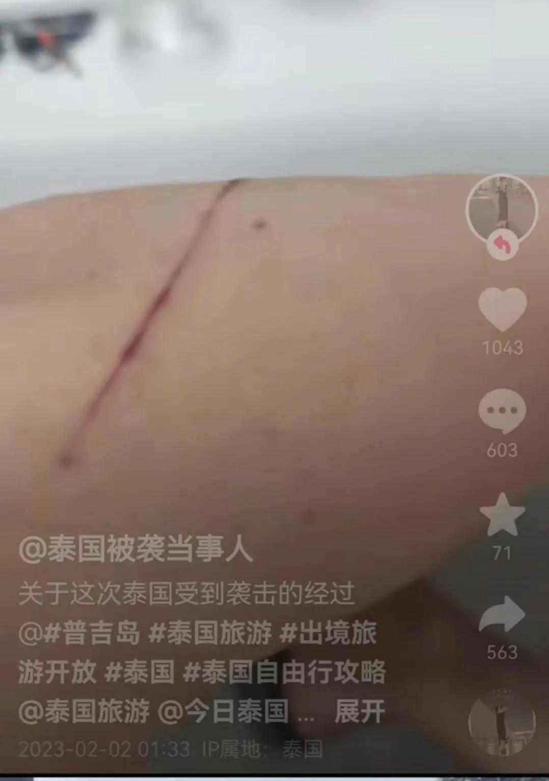 最新消息，中国游客在普吉岛被导游用刀划伤胳膊。曼谷一本地小孩，在家附近的店铺买软