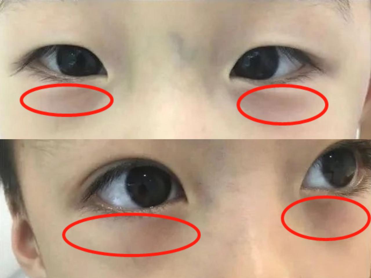和小儿脾胃虚说“拜拜”！
 
近期有很多家长留言说自家孩子积食、食欲差，眼睑发青