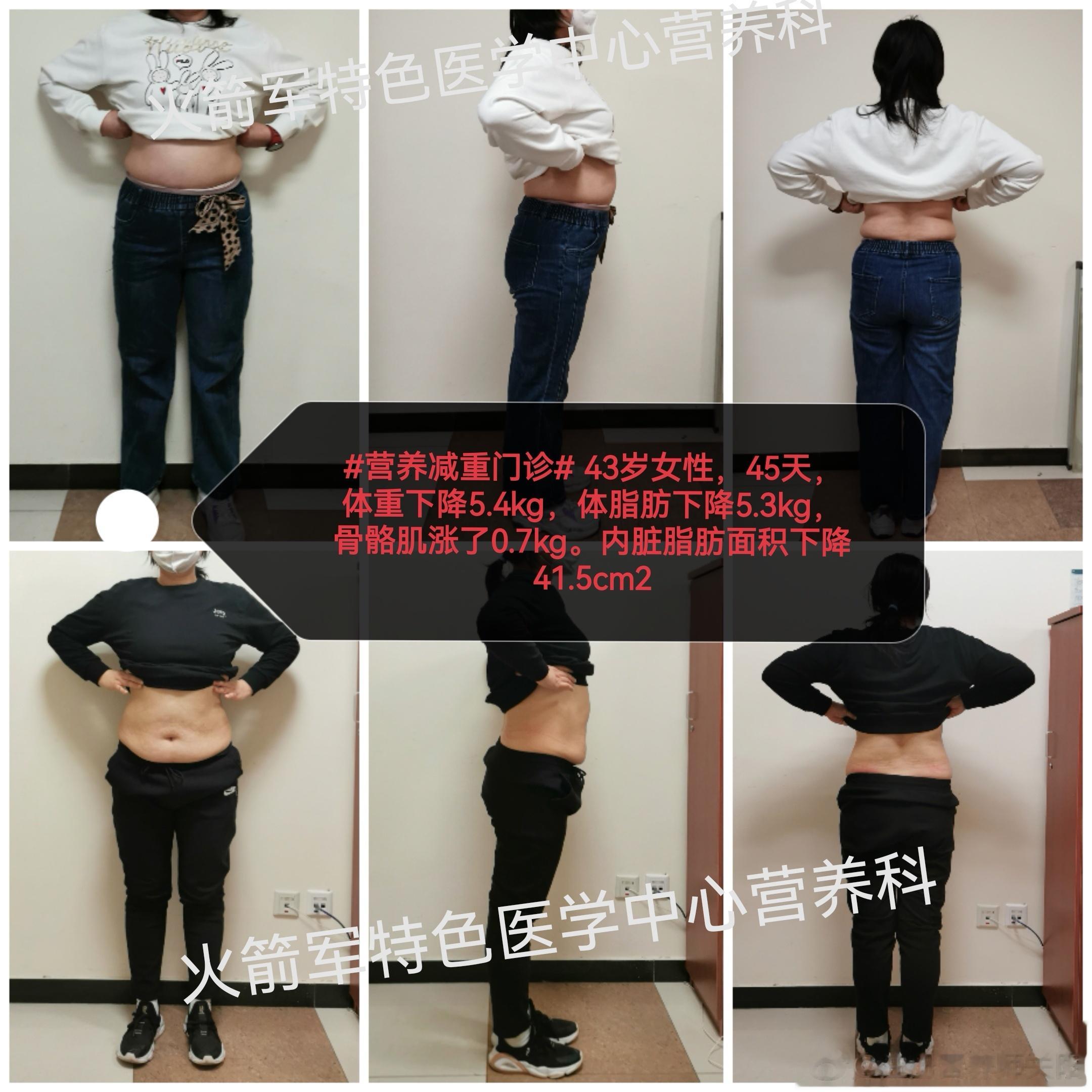 #医学营养减重门诊##家庭健康守护计划##2023活的更好#       43岁